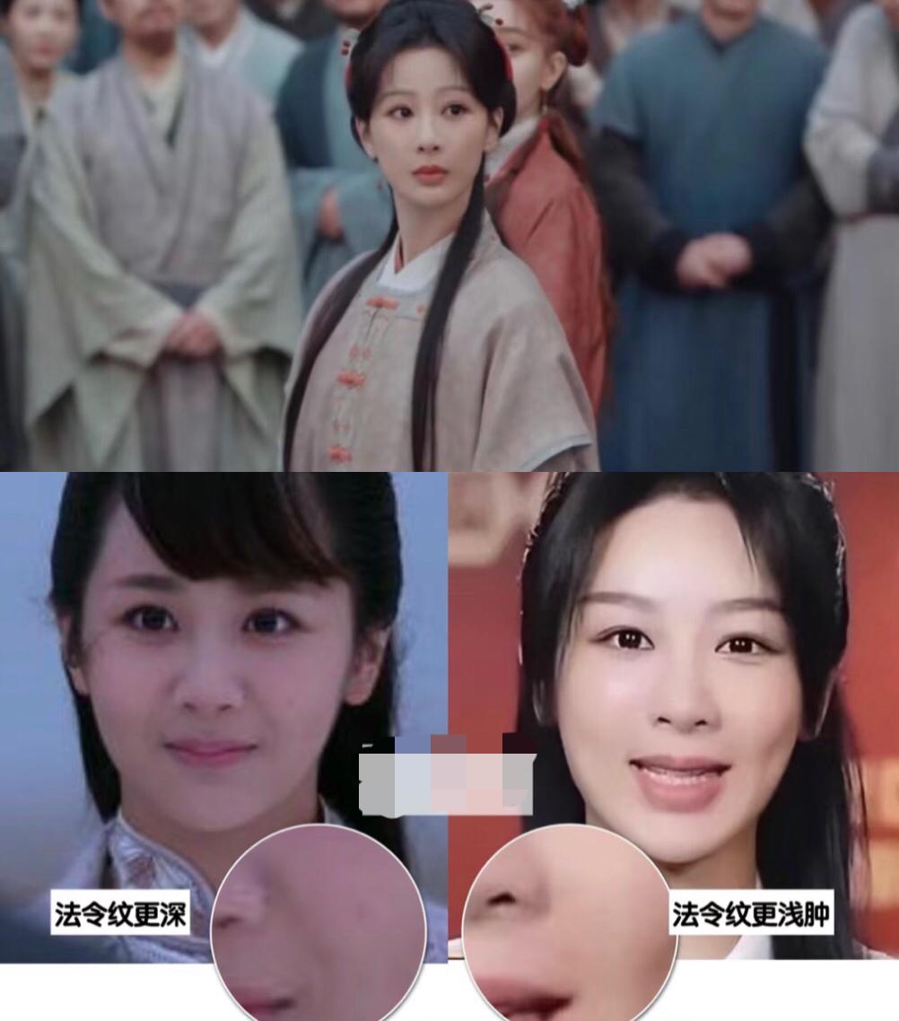 吃惊的发现，原来不是有法令纹就显老的，杨紫每次有新剧抬上来都免不了被审视一番