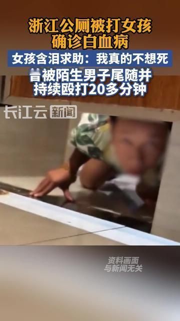 谁能想到？只是去小区公厕接杯水，她就被陌生男劈头盖脸打了一顿。上周浙江那