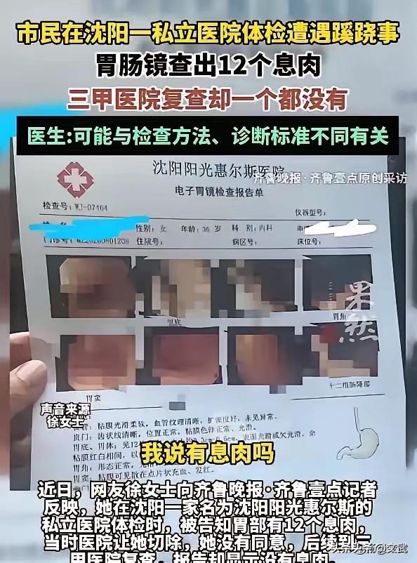 沈阳一女的陪老公去单位定点的私立体检医院做体检，自己顺便加做了个胃肠镜。刚麻醉醒