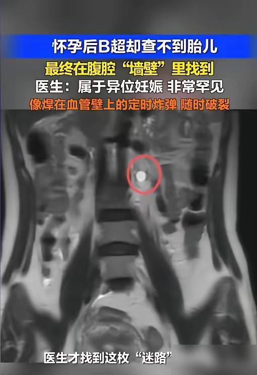 “太惊险了！”5月7日报道，广东深圳，一女子用验孕棒发现自己怀了，她赶紧去了医院
