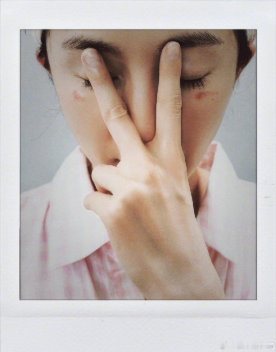 杨幂脸被蒸汽眼罩烫伤了杨幂居然被蒸汽眼罩“咬”了！发博晒出眼下的烫伤红印，语气也