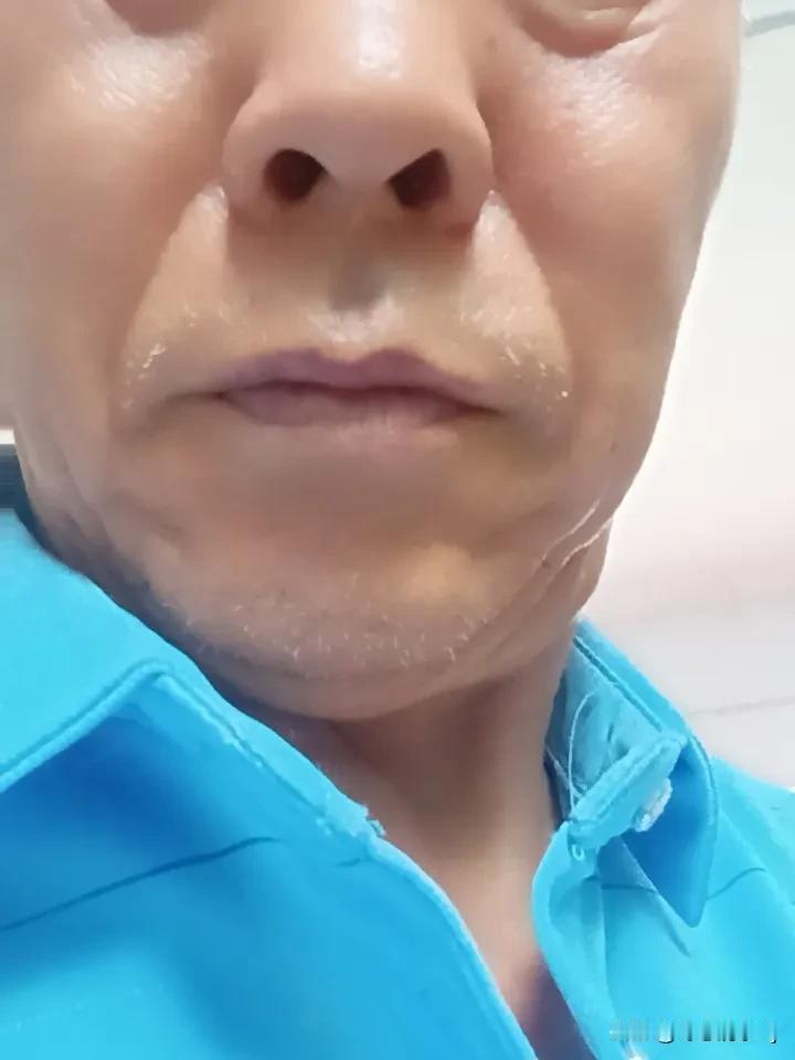 中医推拿真能治病，而且能治的病还不少。就拿颈椎病来说，长时间低头看手机、玩电脑，