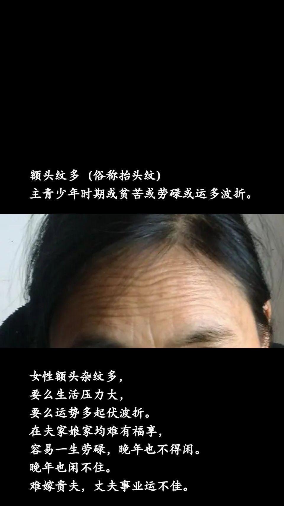 额头纹多（俗称抬头纹）主青少年时期或贫苦或劳碌或运多波折。女性额头杂纹多，