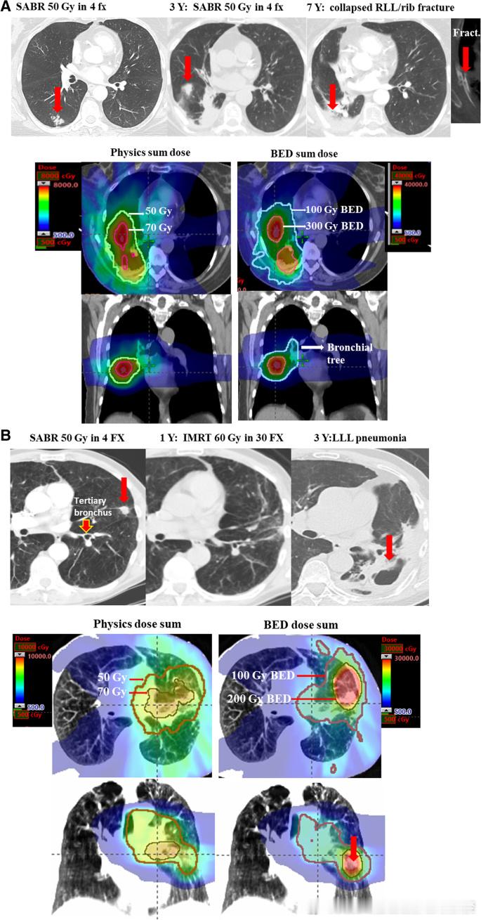 在我连任美国放射科学院（AmericaCollegeofRadiology