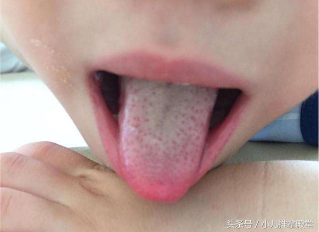 孩子嘴巴酸臭, 妈妈按积食推拿, 不到10分钟就睡着了