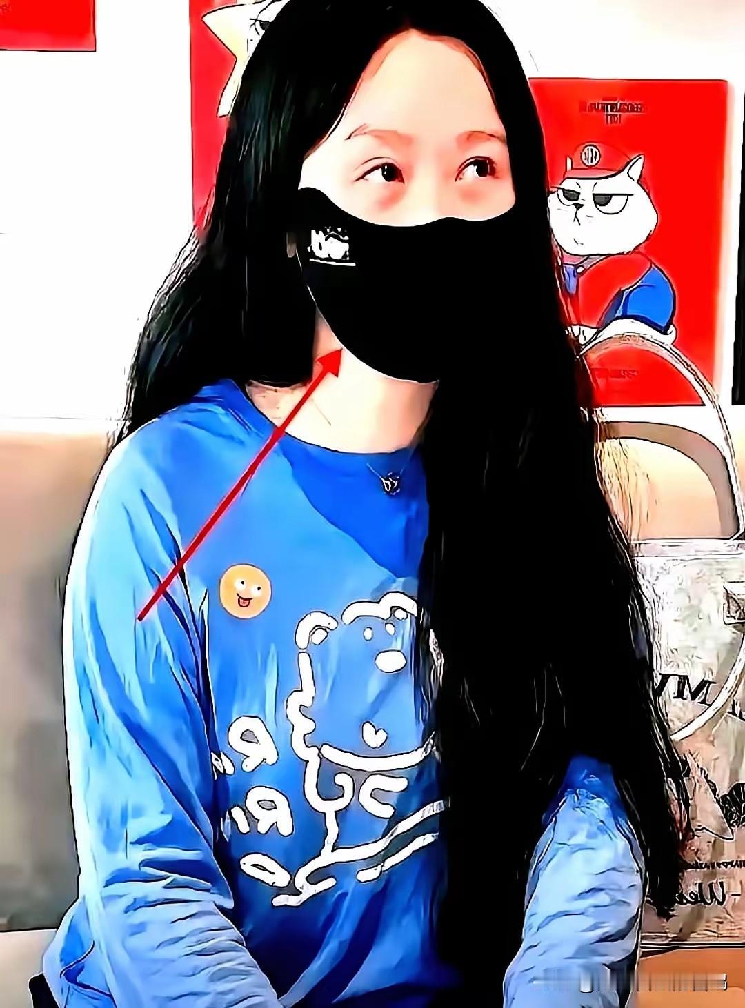 狗咬人还一千罚款+拘留五天？对某些养狗的，跟挠痒痒一样。昨晚发生在我们小区里