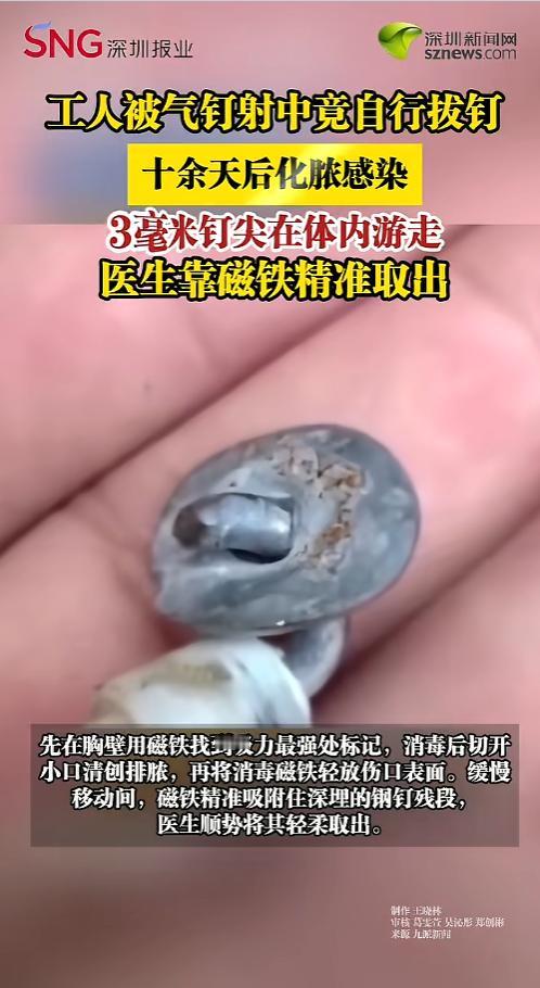 “是个狠人！”5月15日深圳新闻网报道，福建泉州，一名男子干活时被气钉枪打中，气