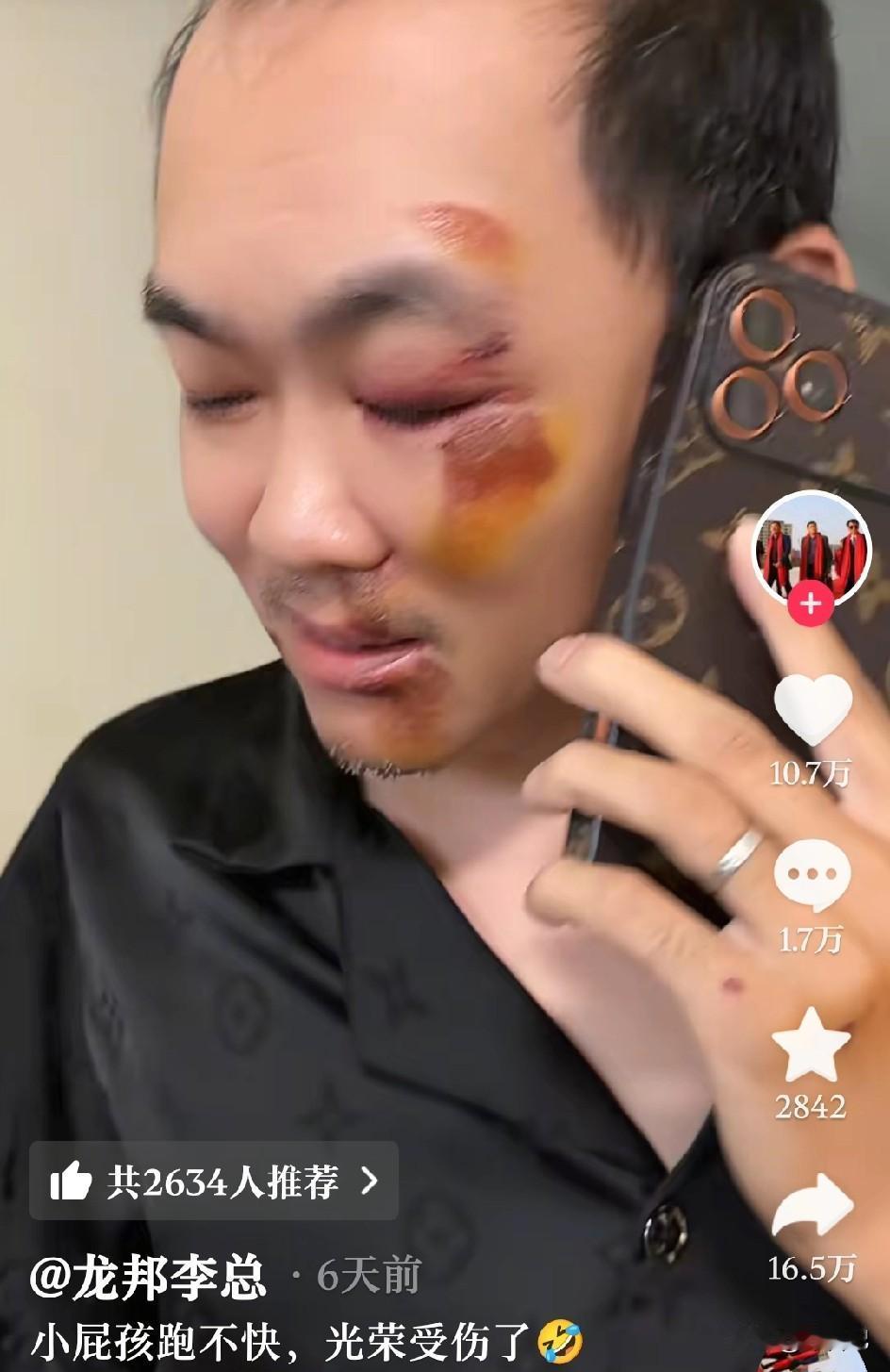 看热闹上新闻的也就这一个人。一名中国公民受伤，原来是叔叔和侄子去看泰缅打仗，