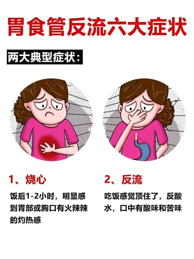 胃食管反流这些症状要注意了!