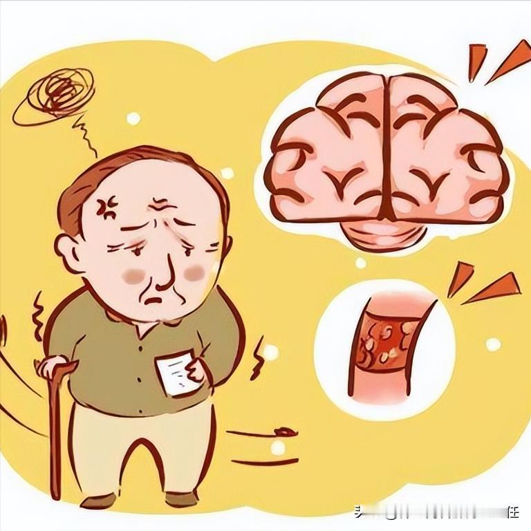 脑梗后锻炼3大禁忌！做错可能加重病情 1.高强度锻炼三种行为是最常见的错误