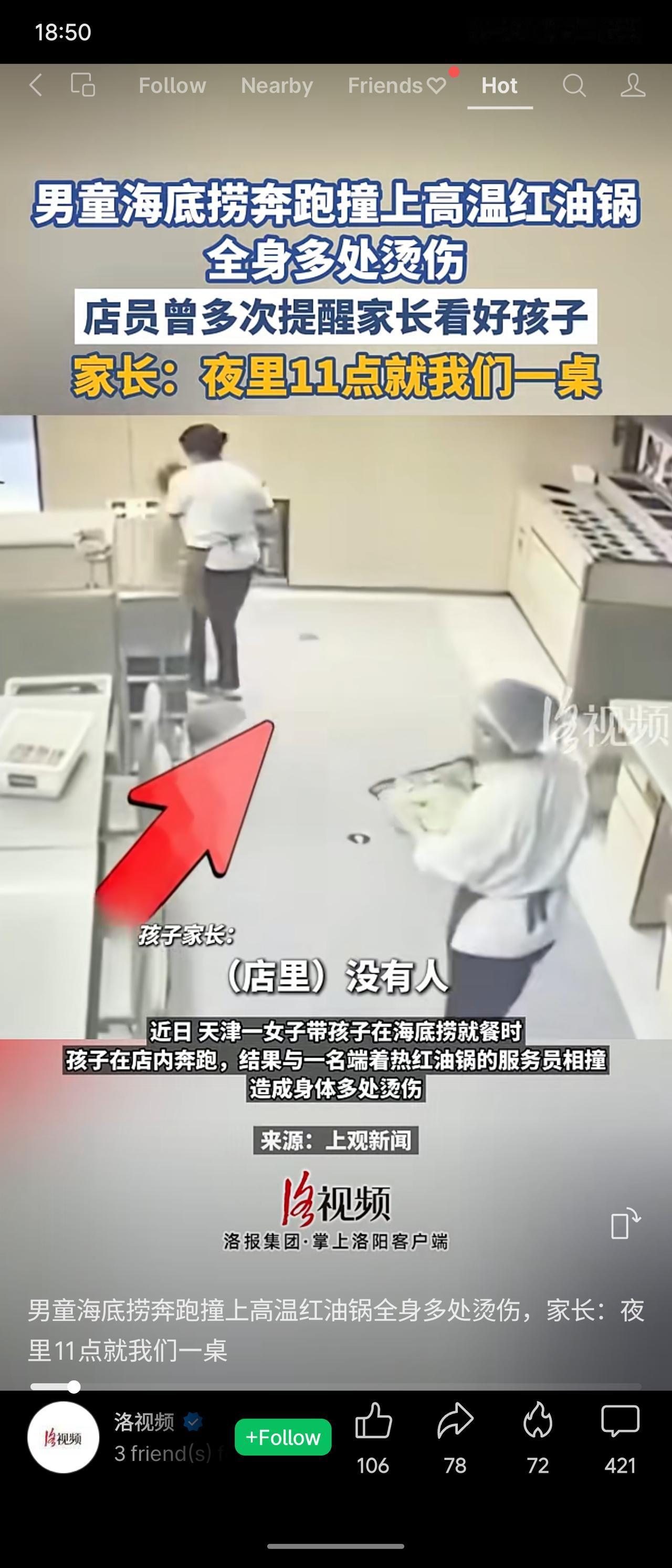 天津一男童在海底捞店内奔跑，与端热红油锅的服务员相撞，致全身多处烫伤。店员曾多次