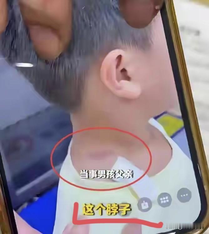 有的人脾气应该是娘胎里带的，这种病得好好地“治”！说不定，有时候一个巴掌或许