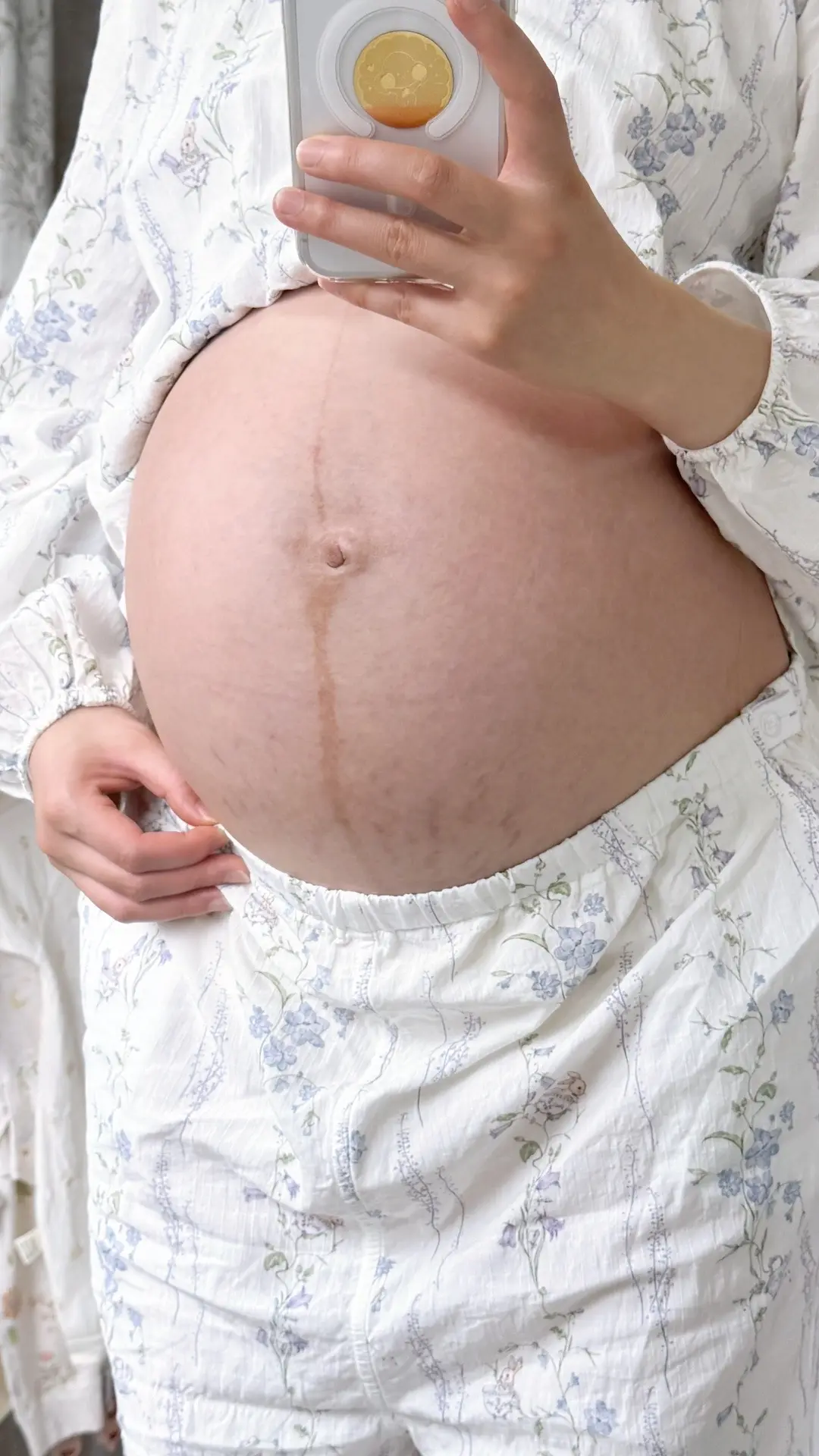 当我看到妊娠纹出现的那一刻 仿佛在和我的青春道别