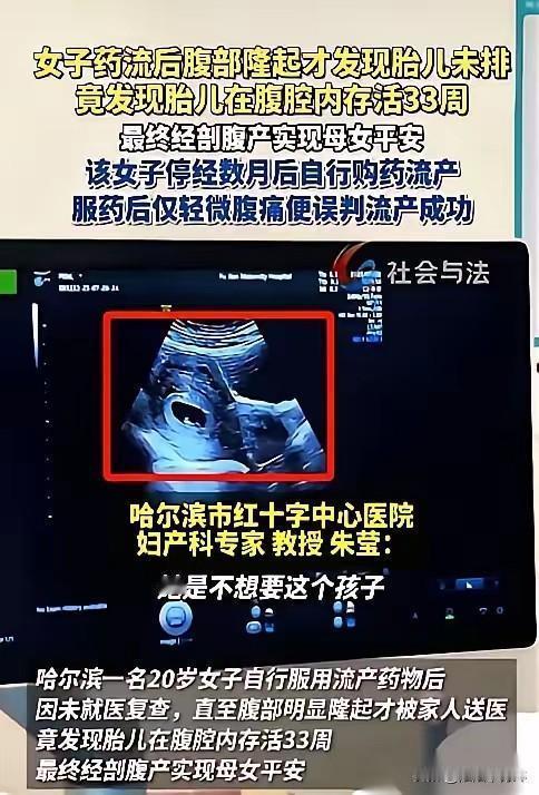 哈尔滨一个20岁的姑娘，吃药想把孩子打掉。结果B超探头一放上去，医生当场就傻了。