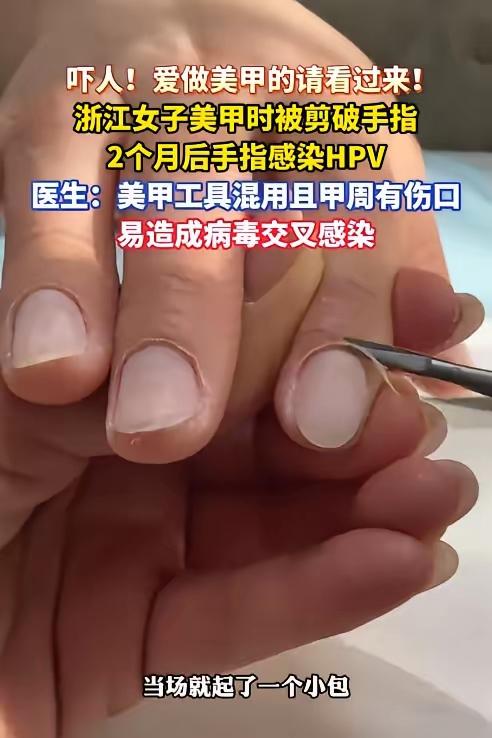 “太可怕了！”浙江杭州，一女子在美甲店被未经严格消毒的工具剪破手指。可没曾想两周
