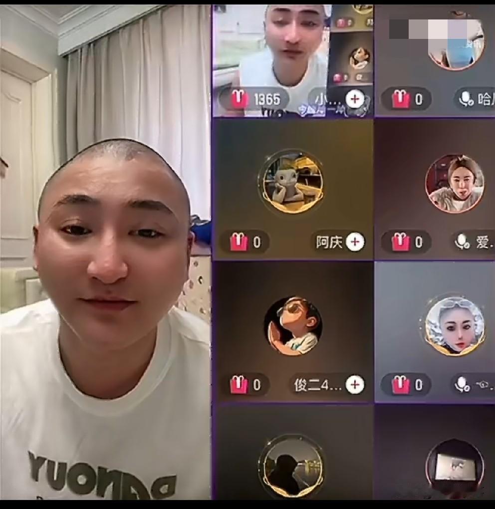 铁岭小辉“脑出血”回来变身“王木生”展示陈年老疤！小辉开