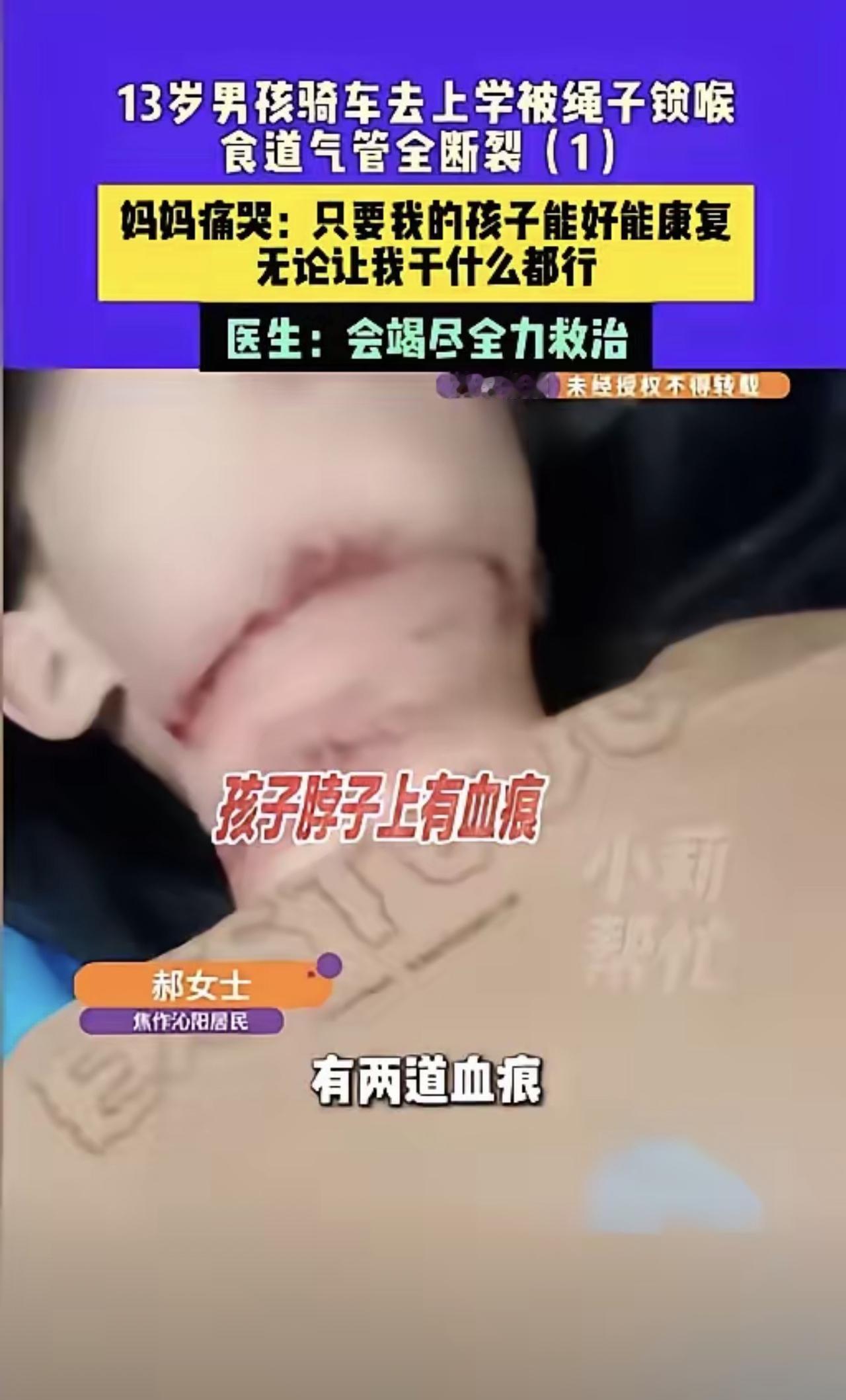 真的让人胸口发闷！河南焦作一名13岁男孩竟遭遇绳索勒颈意外。要知道这个孩