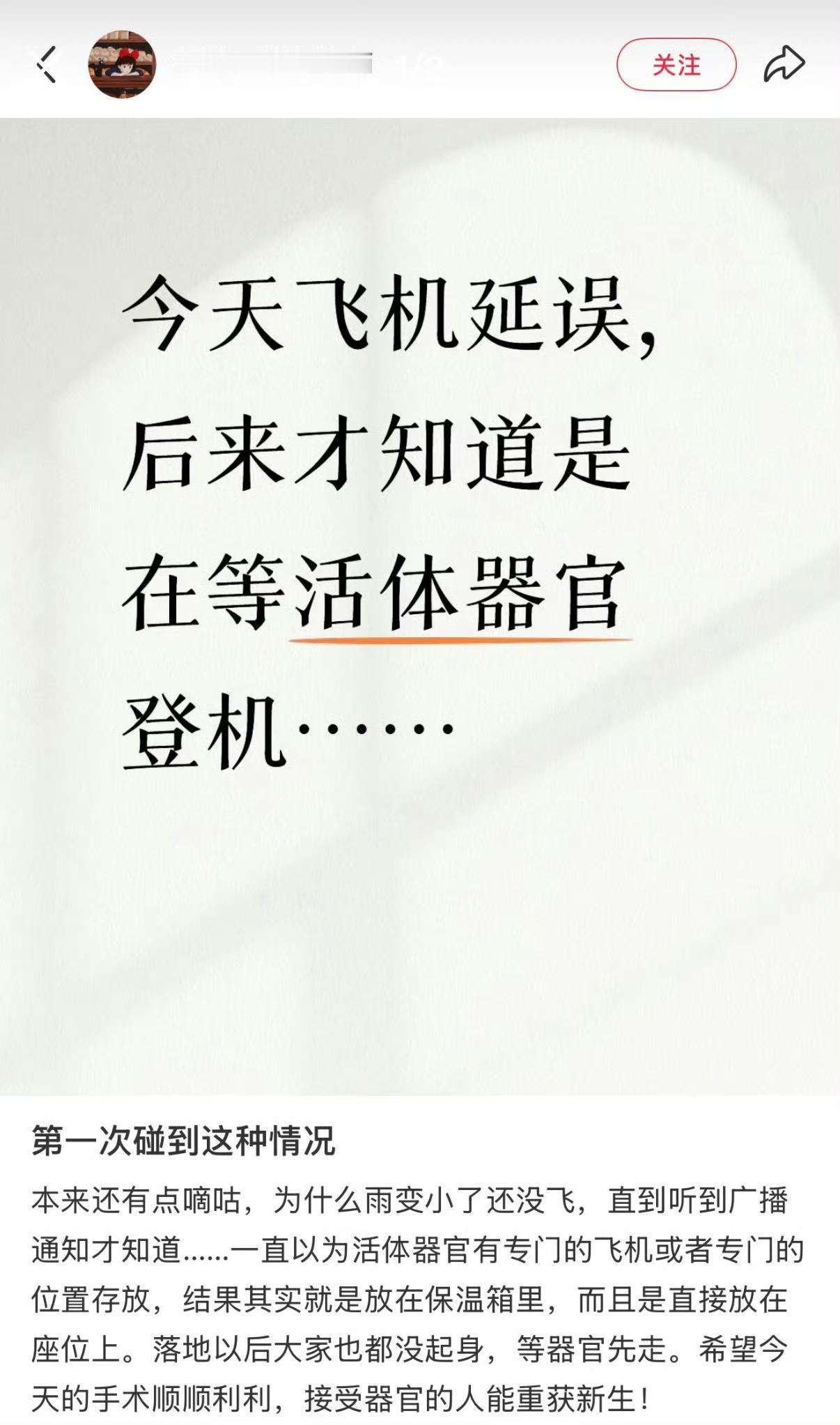 原来活体器官运输不是专门的飞机​