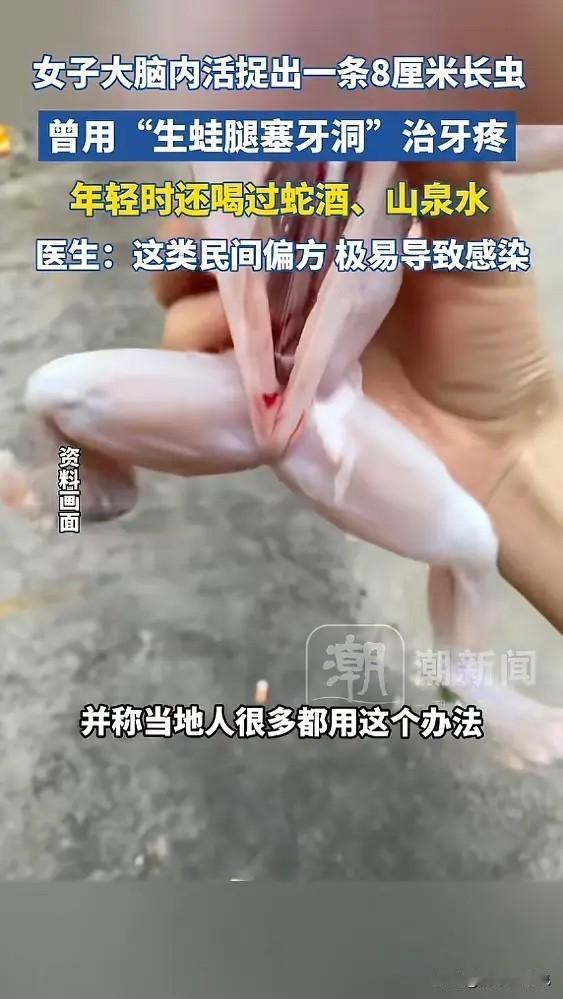 “太吓人了！”广东梅州，一女子因为牙痛，竟用生的青蛙腿塞牙洞，“钓牙虫”来缓解症