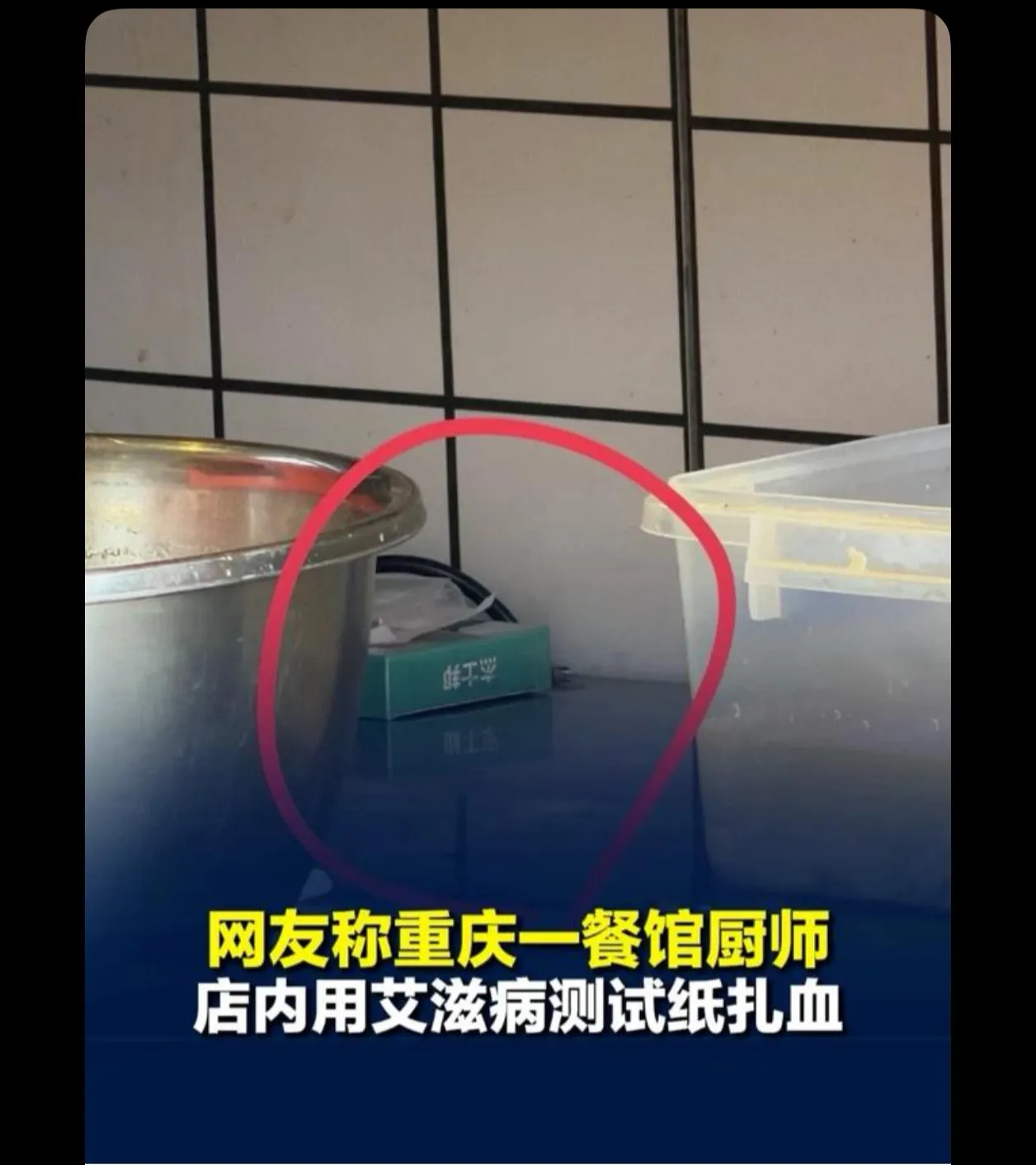 艾滋病人做的饭我敢吃，乙肝病人做的饭我是真不敢吃。艾滋传染有局限性，乙肝传染强度可比艾滋厉害多了正常
