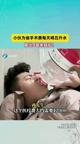 上海一位大哥体检时，左肾被查出有颗9mm的结石。医生说：“手术费一万二。”大