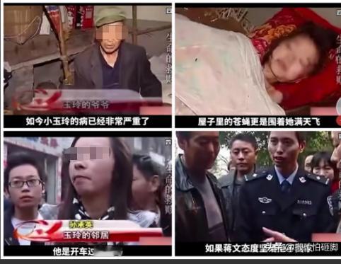 熬过满身溃烂的苦，她终于等来生活温柔，爷爷每天拿镊子，从她后背腐烂的地方里一条条