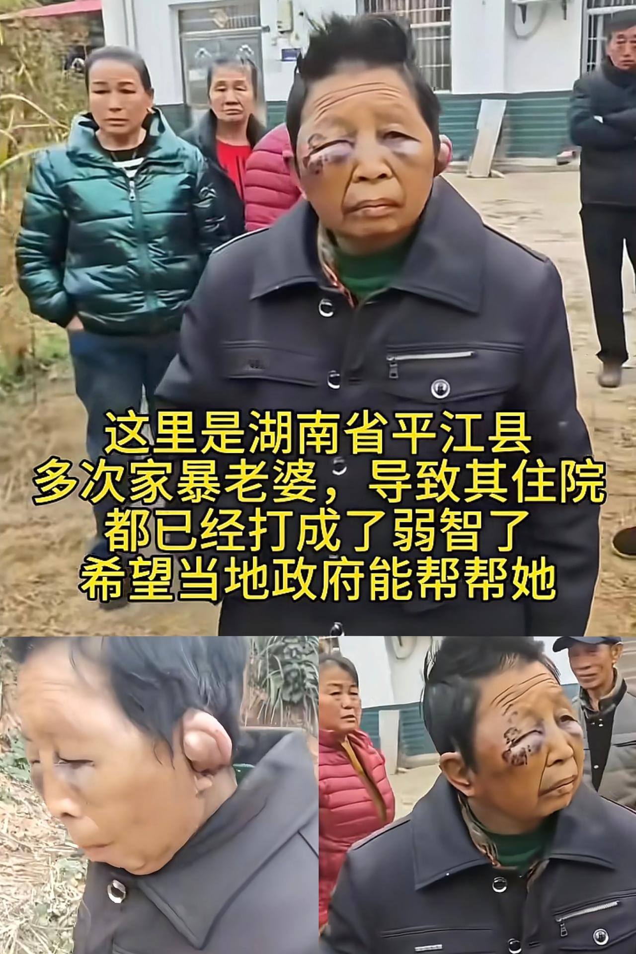 不敢想她才40多岁40多岁的年纪，却被家暴磋磨成60多岁的模样，湖南平江这位