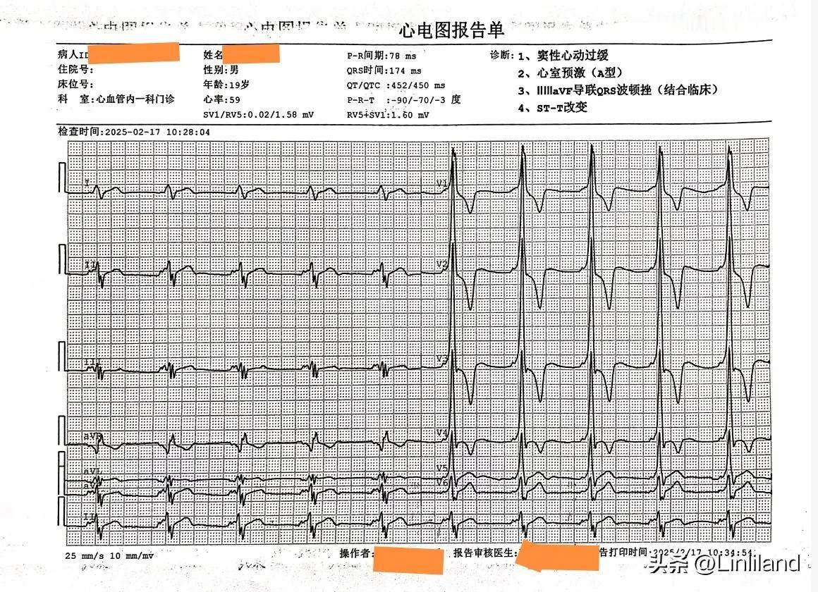 19岁小伙因征兵体检时心电图异常来诊。他没带心电图，也说不清心电图的具体情况，于