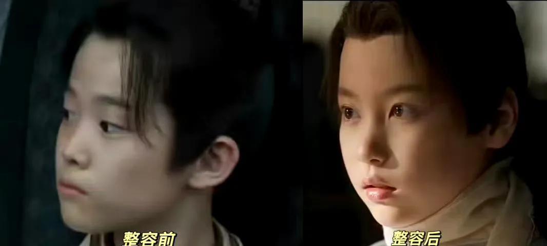 藏海传的导演你醒了吗？反正我是被笑得一直醒着稚奴从小就开始整容，所以长大了才