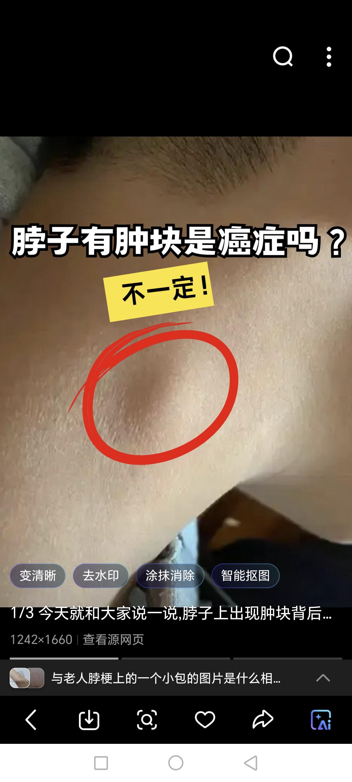 没有什么持别感觉，就是觉得穿衣服后脖梗子跟衣领紧挨着有磨擦不舒服。孝顺的儿子