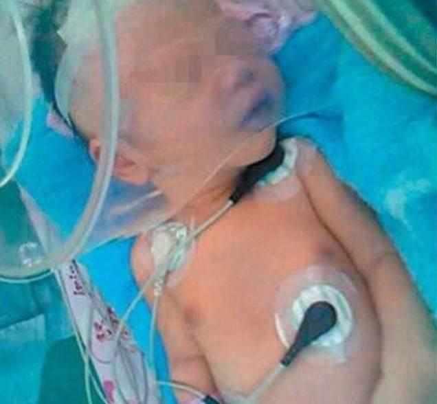 奶奶喂养不正确, 6个月宝宝就这样走了