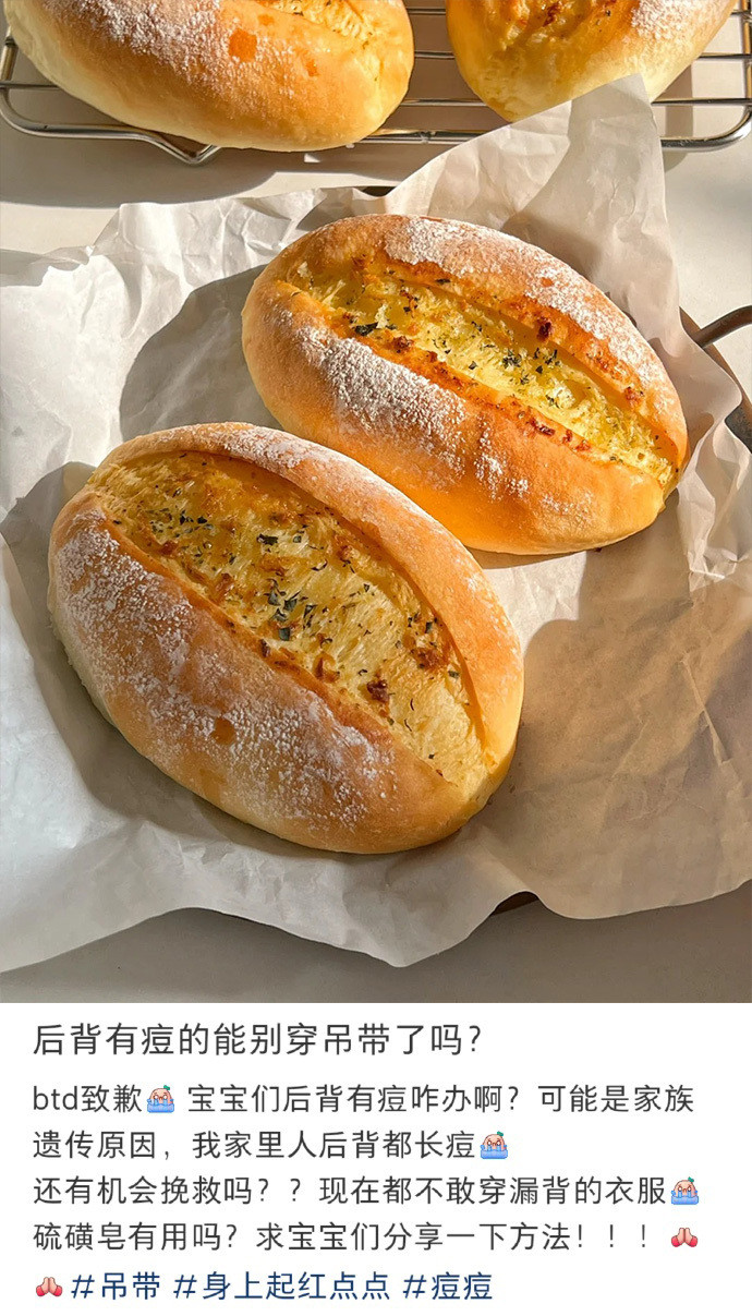 后背有痘的能别穿吊带了吗?​​​