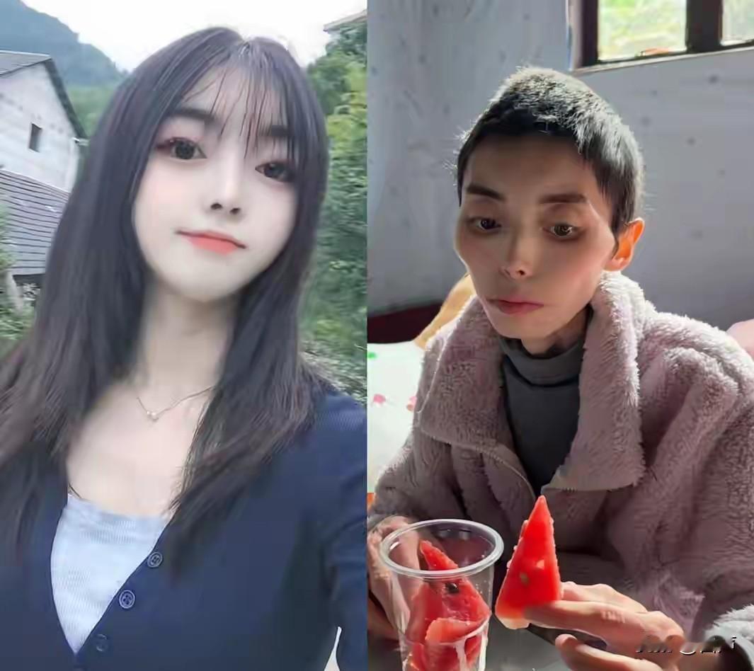 31岁贵州美女周艳去世人瘦到只有30斤去世原因是患上了胃印戎细胞癌。都