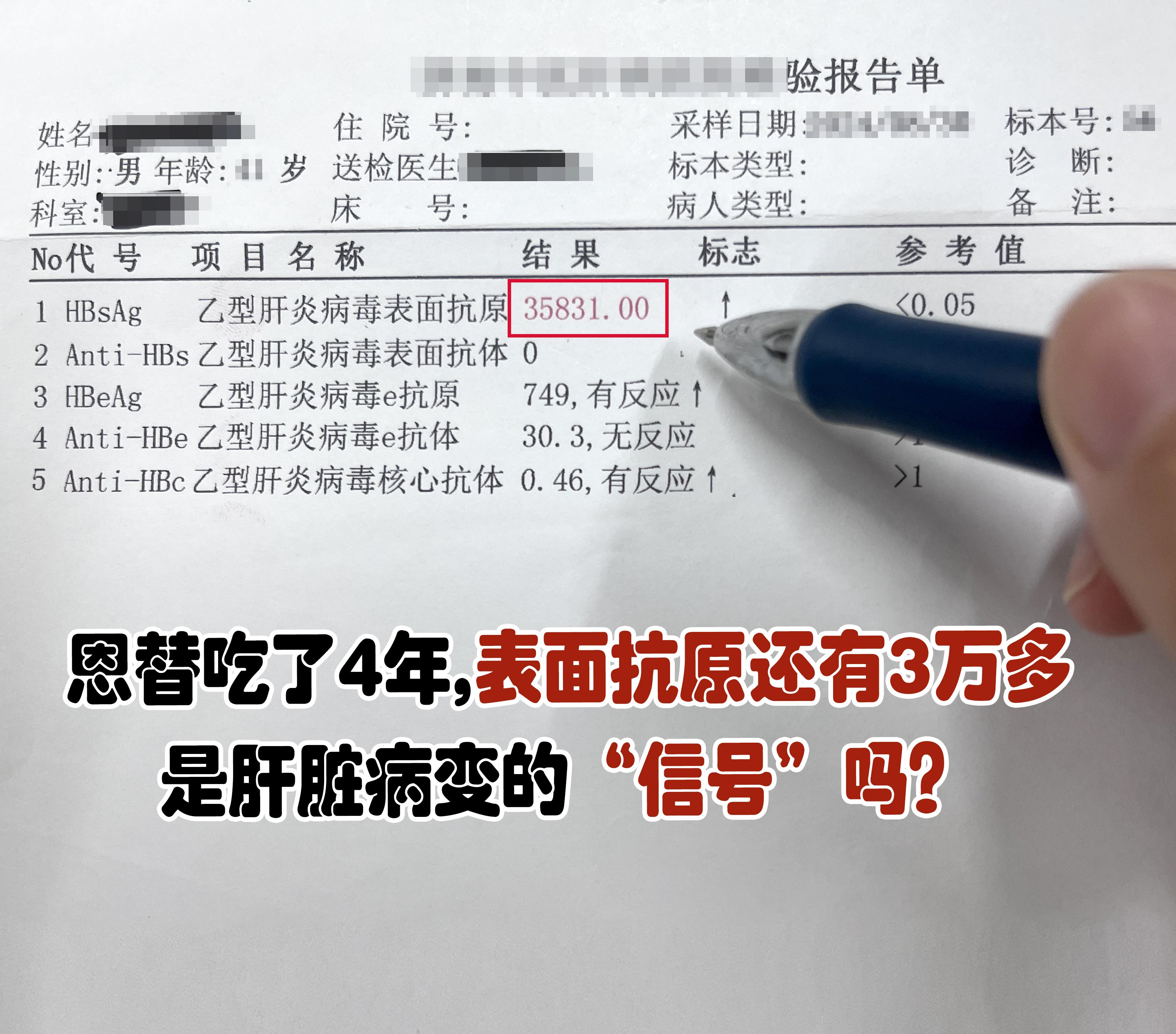 吃了4年的恩替卡韦，表面抗原还有3万多，是肝脏病变的“信号”吗？ 前两...