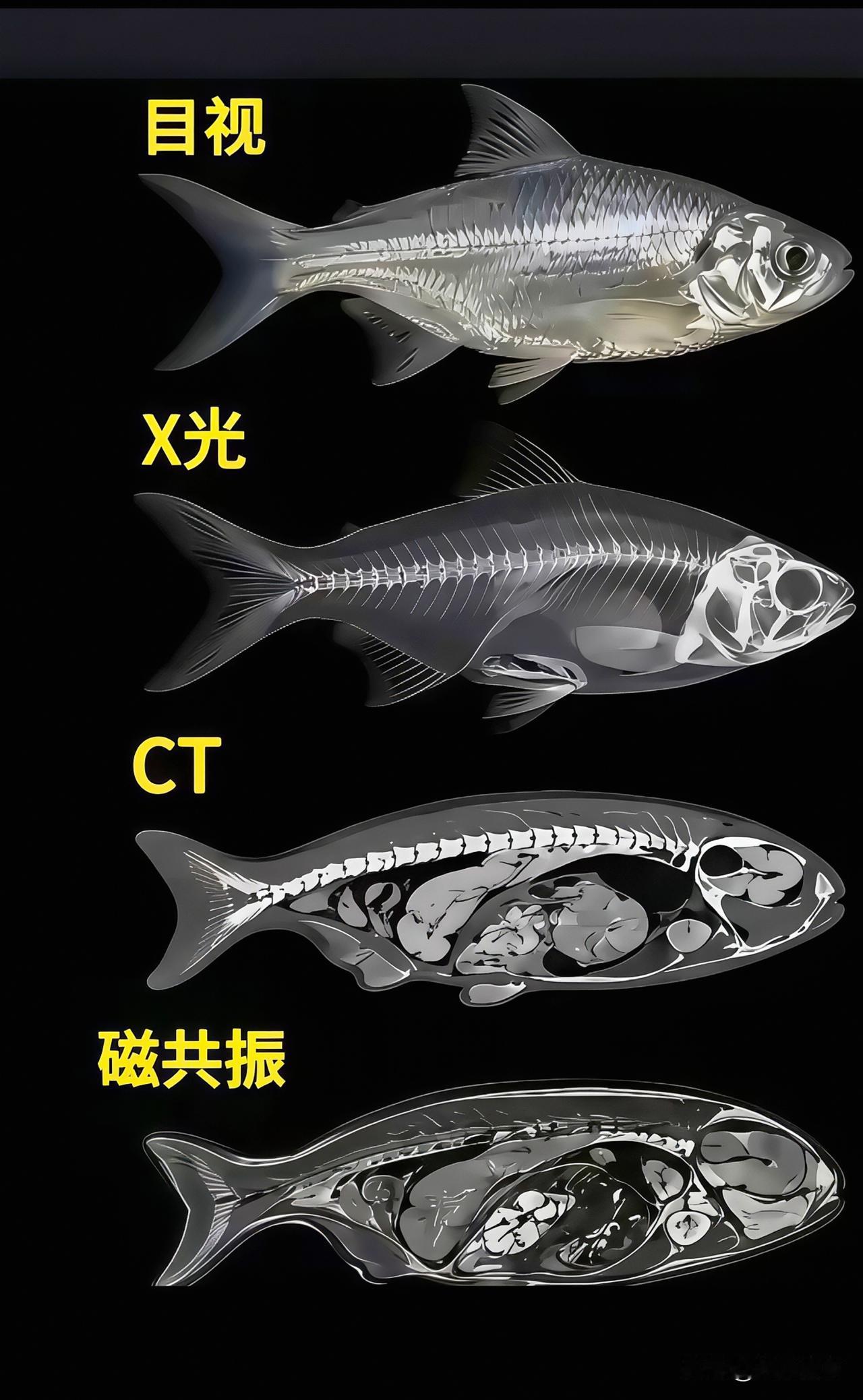 一条小鱼，带你看懂四种检查到底差在哪…大家平时去医院，总会听说X光、CT、