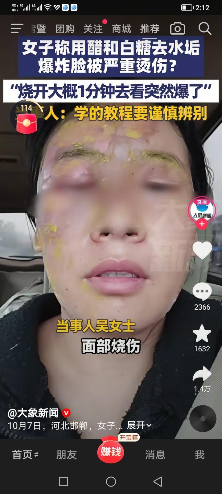现在网上经常有一些博主教生活小妙招的，大家平时一定要注意安全，不要什么方法都信，