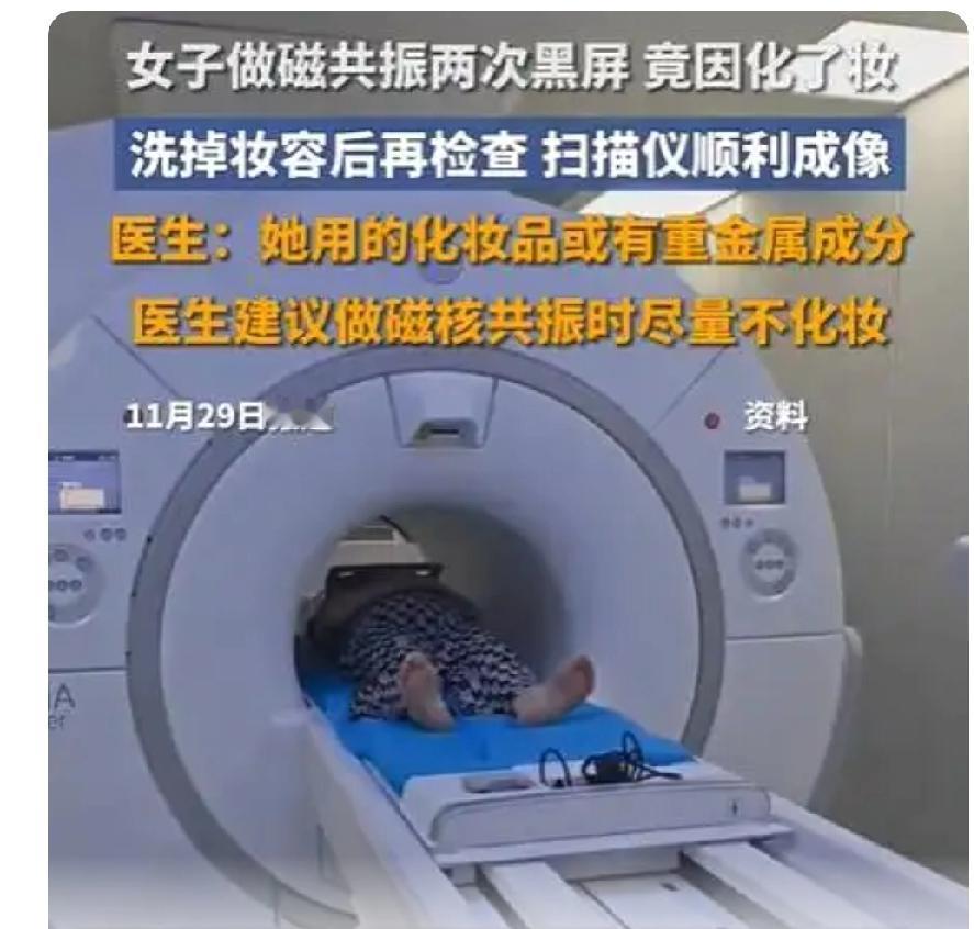 一位女性因两次磁共振检查“黑屏”而困惑不已，最终发现罪魁祸首竟然是她的日常化妆品