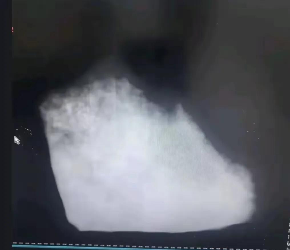 现在高科技的手段已经把原石看得清清楚楚，明明白白了，所以流落到市面上的原石都是被