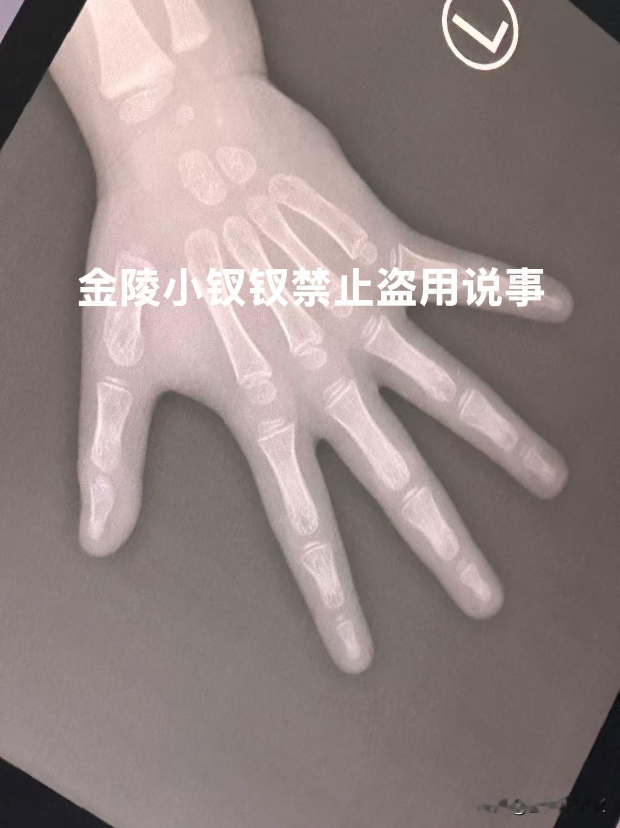 说不出的难受今天中午原本带着好好兴兴的老妈去饭店吃饭，没想到一场突发的意外让