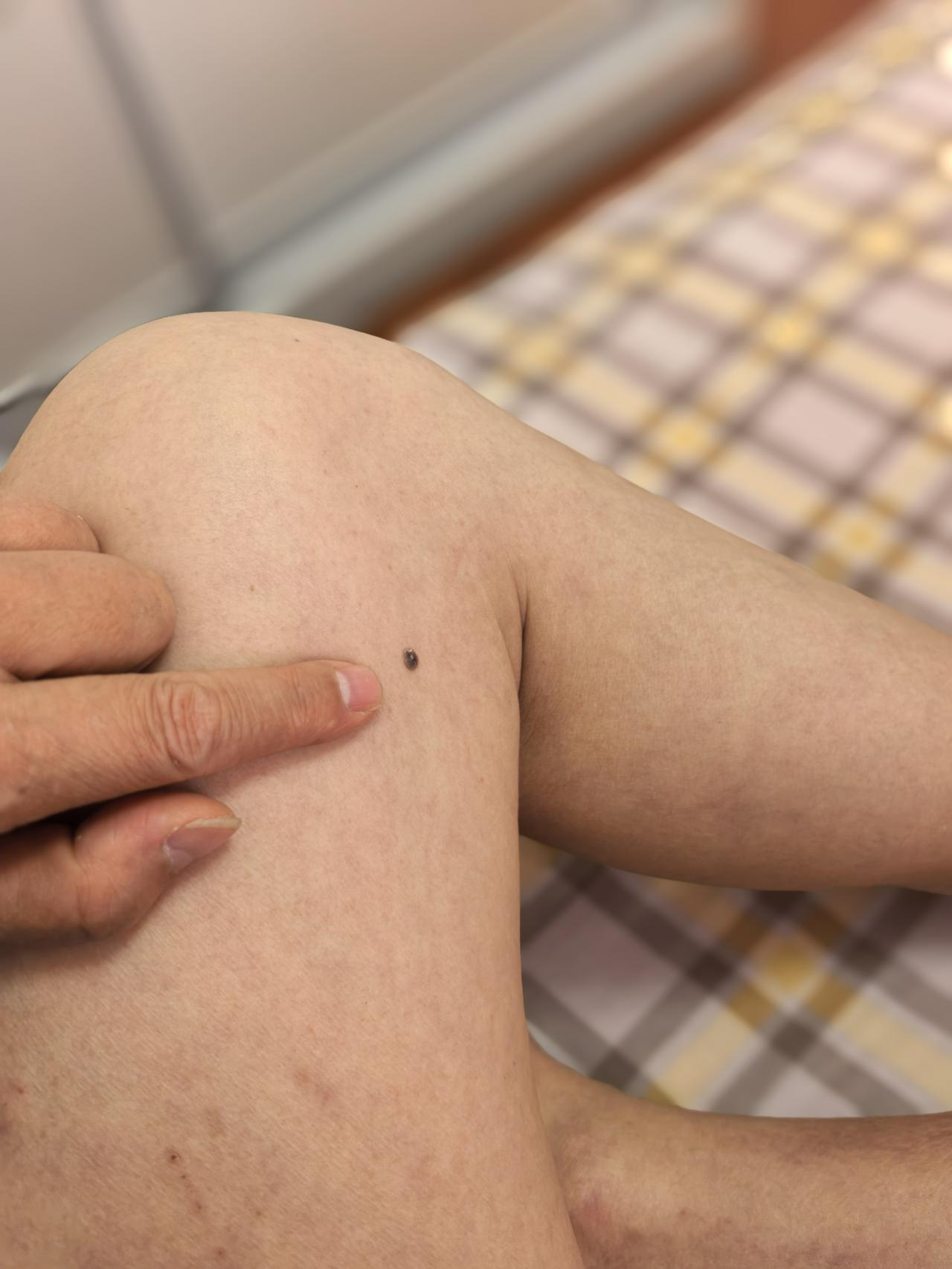 酒龄四十年，如今已经戒酒267天，全程滴酒未沾。不知道是不是戒酒的缘故，这