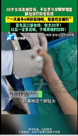 【20岁女孩一天4杯奶茶险截肢，医生都傻眼了！】河南郑州一20岁女孩确诊糖尿病后