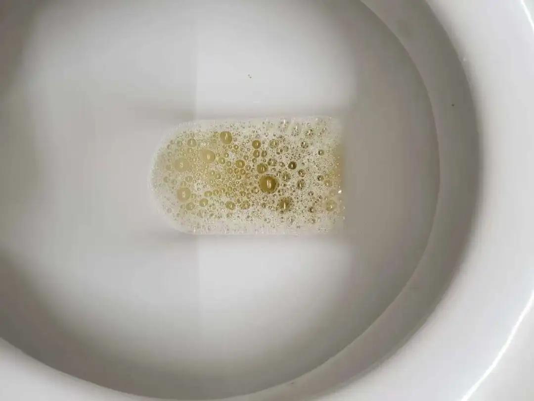 救命警报！喝水后出现这4种信号，可能是肾脏在“拉响警报”肾脏是