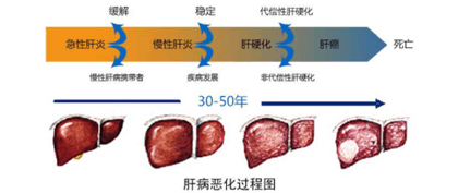 终末期肝病模型评分预测亚急性重型肝炎近期预后的价值