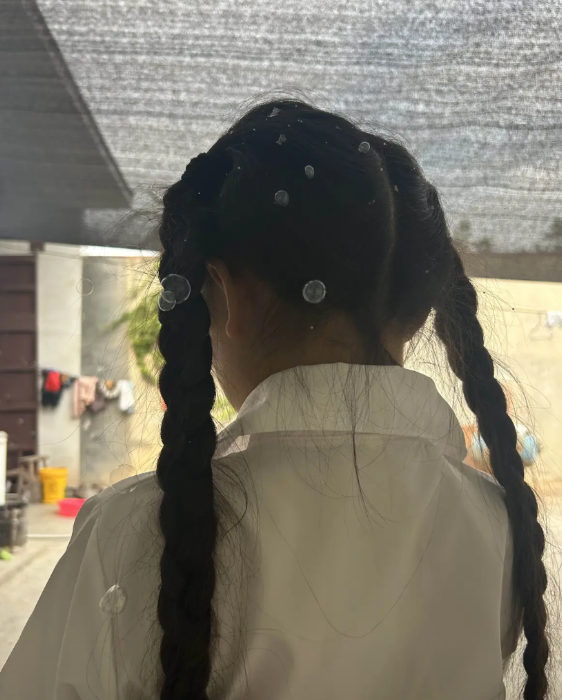 我真是惊掉下巴了！天水幼儿园汞中毒根源居然说是后厨用颜料做食物。这事听起来就离谱