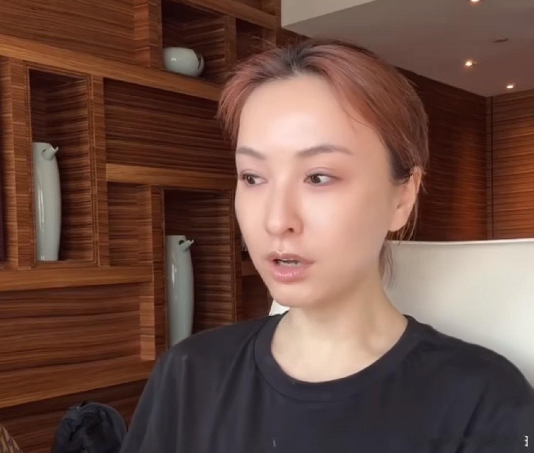 吴昕的脸怎么了女艺人搞医美很正常，再加上刚睡醒的状态，挺正常的，难道就我一个人看