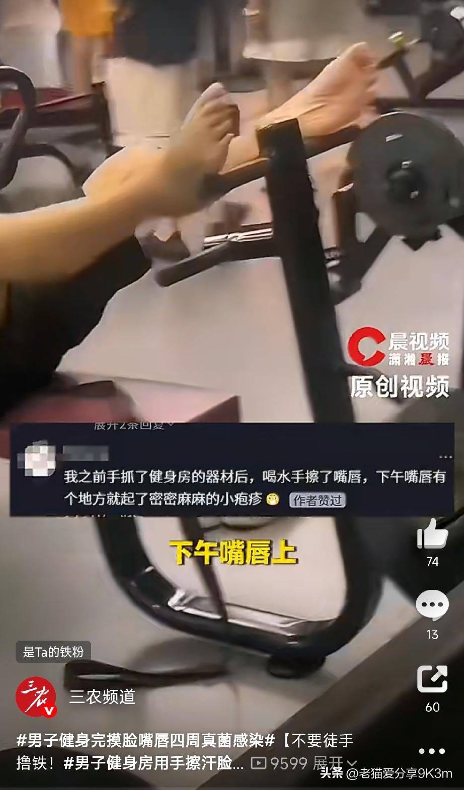 从没想过撸铁也能毁容！广东一哥们用摸完器械的手擦了把脸，第二天嘴唇周围又红又