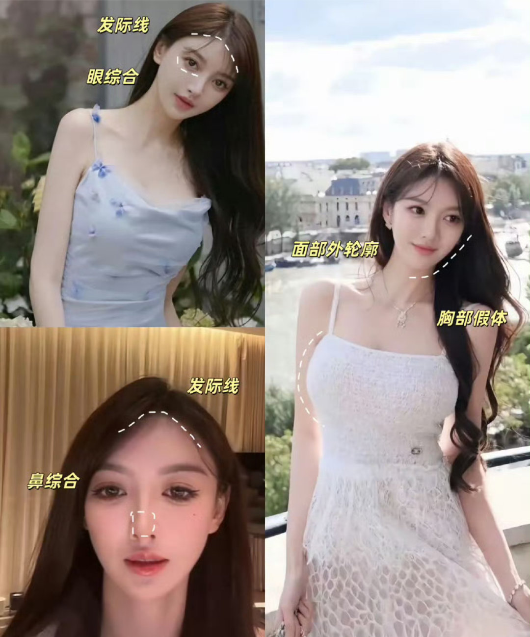 叶珂自曝医美过度叶柯全身有没有做过的地方吗[笑着哭]这个医美一旦开始就停不下来