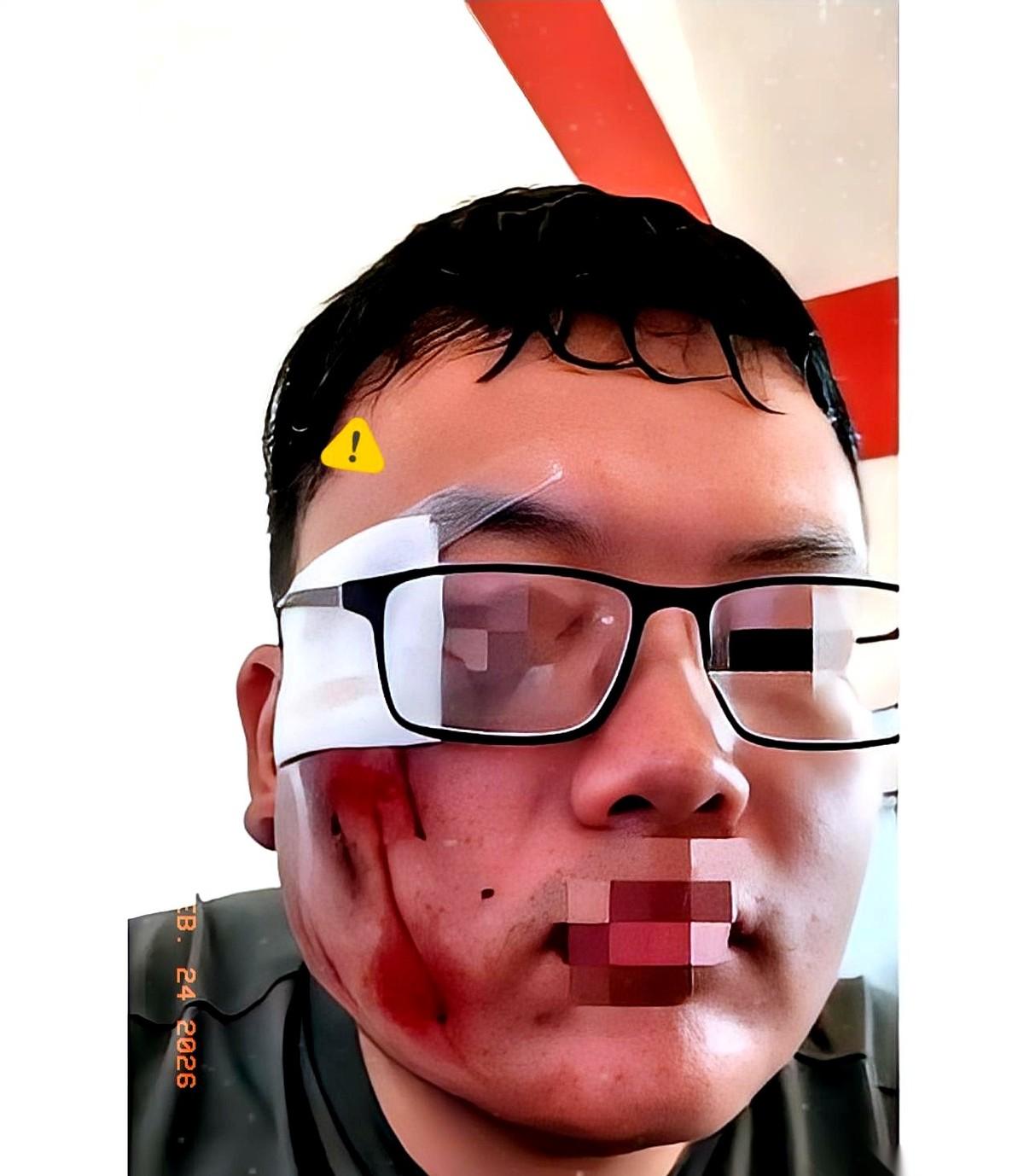 他递给我1000块，想私了。我没要，反手开了张2000的罚单，心里还觉得自己特