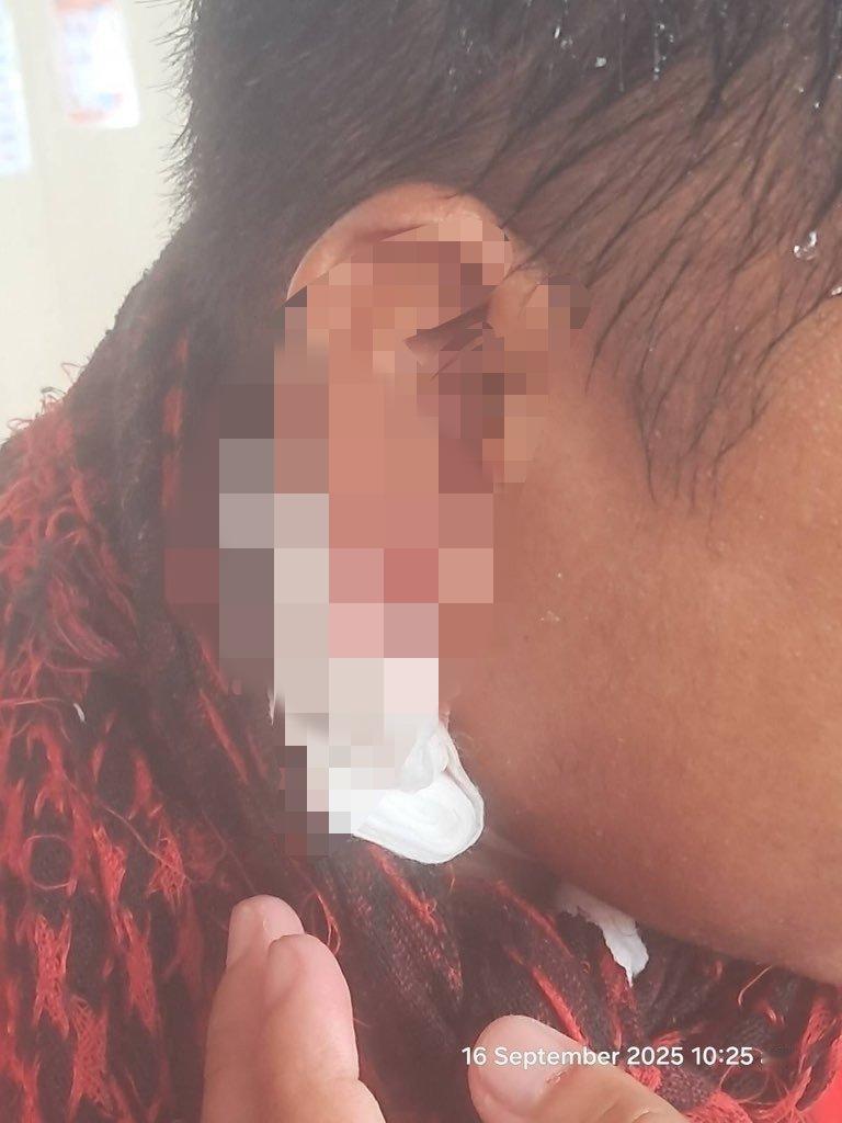 黄岩岛对抗，菲律宾海岸警卫队官兵出现伤情：一人耳朵被玻璃碎片击中，向中方打出白旗