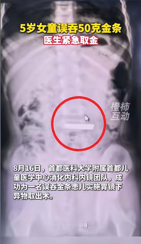 “危险！”8月16日，北京，家长带着个女孩冲进了医院，说女孩吞金了！原来，女孩在